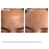 Beauty Flash Peel Face Exfoliator - 