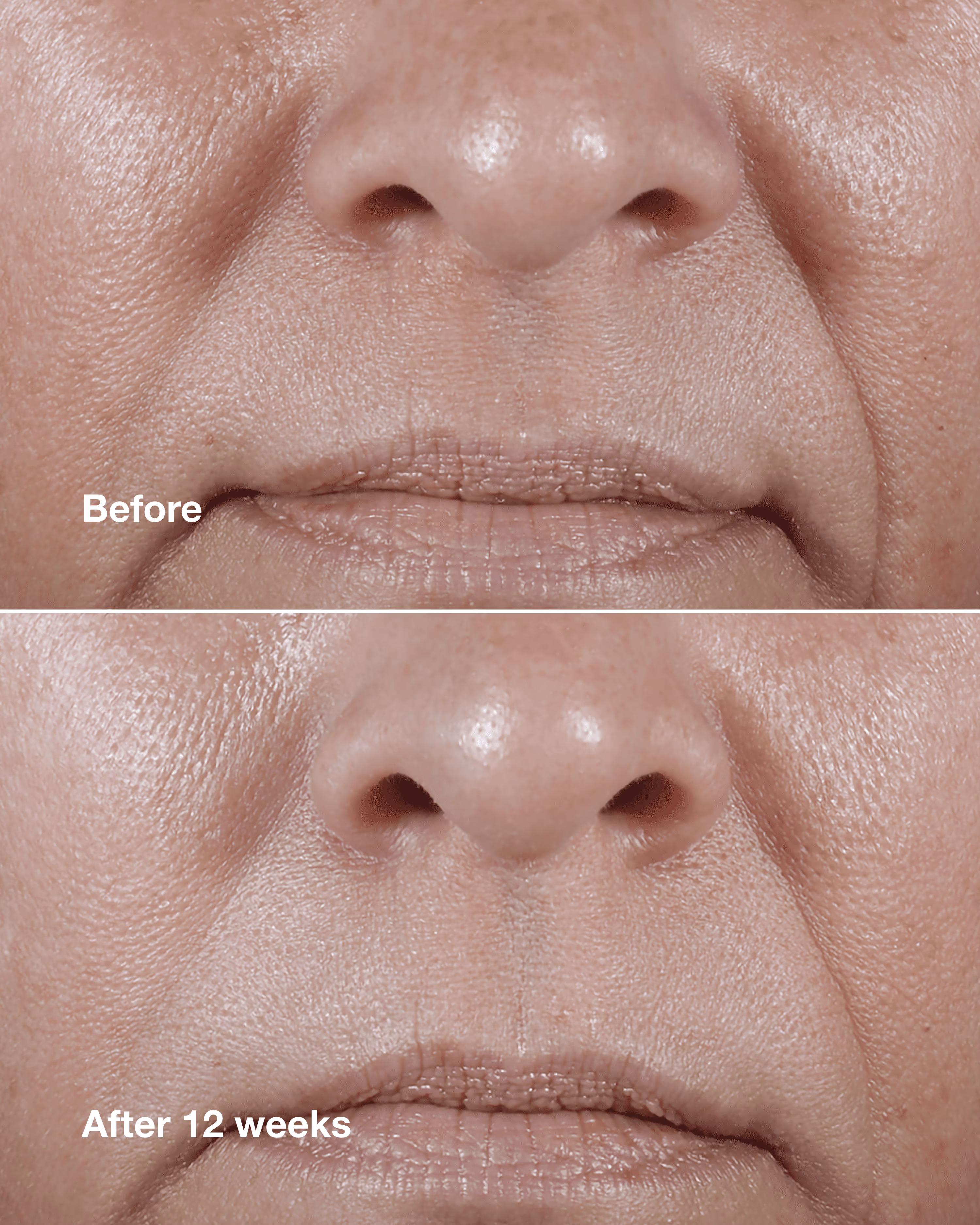 Smart Clinical Repair Wrinkle Correcting Rich Cream - 
