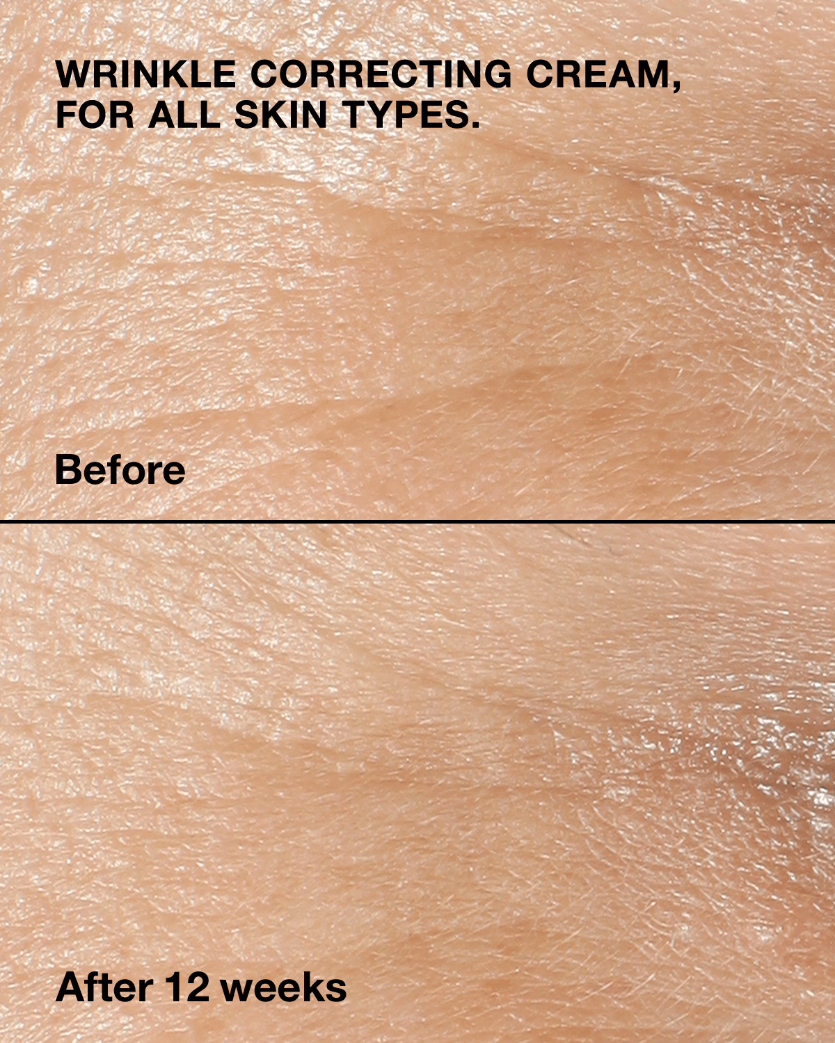 Smart Clinical Repair Wrinkle Correcting Cream - 