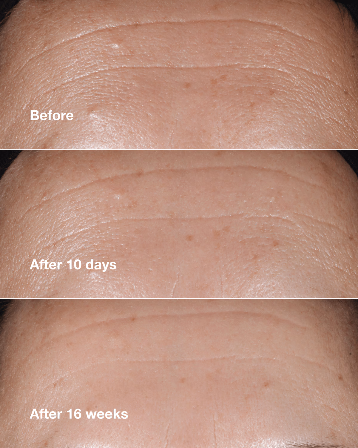Smart Clinical Repair Wrinkle Correcting Serum - 